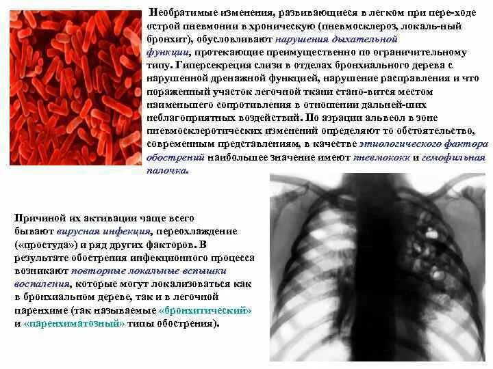 Изменения при хронической пневмонии. Видимые слизистые при пневмонии. Необратимые изменения.