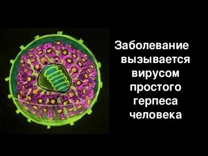 Код вирусы герпеса