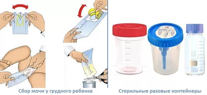 Как собрать мочу мальчику 2 месяца