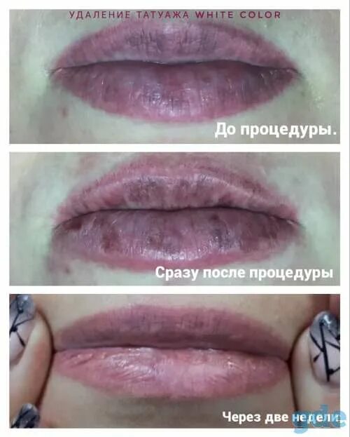 Можно после татуажа идти в баню