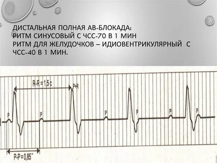 Блокада код по мкб 10