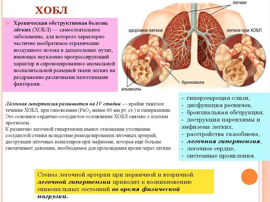 Есть ли хронические заболевания. Хроническая обструктивная легочная болезнь. Для хронической обструктивной болезни лёгких характерно. Хроническая обструктивная болезнь легких ХОБЛ симптомы. Хроническая обструктивная болезнь лёгких симптомы.