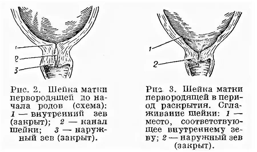 Зев шейки матки закрыт