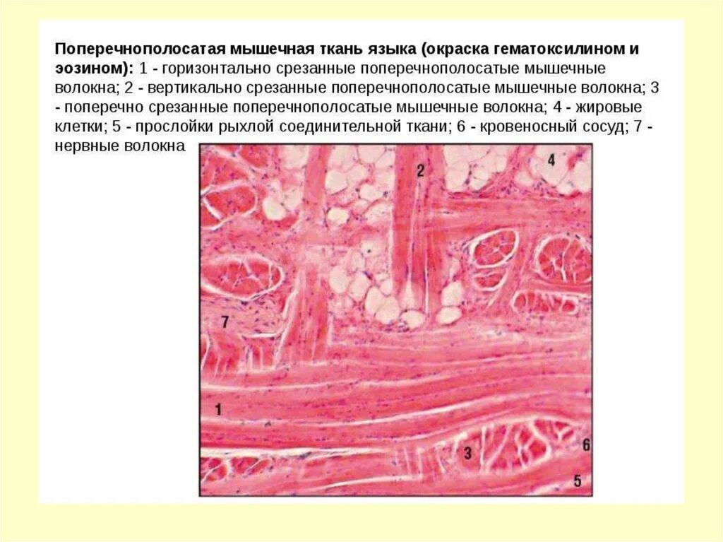 Поперечно полосатая мышечная ткань языка кролика гистология. Скелетная мышечная ткань гистология препарат. Поперечно-полосатая Скелетная мышечная ткань языка препарат. Поперечнополосатая Скелетная мышечная ткань гистология язык. Препарат поперечно полосатая мышечная ткань