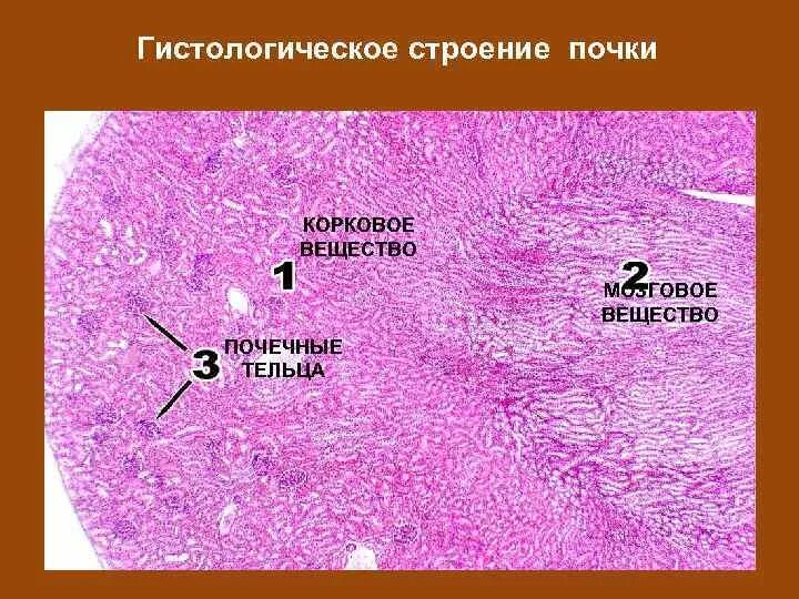 Почка гистология препарат. Структуры мозгового вещества почки гистология. Корковое вещество почки препарат. Срез почки крысы гистология.