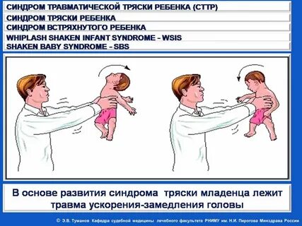 Эпилептический синдром у детей