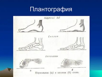 Плантография
