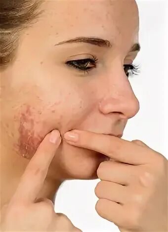 Как выглядит нездоровая кожа Skin Discoloration On Hands photos and vectors
