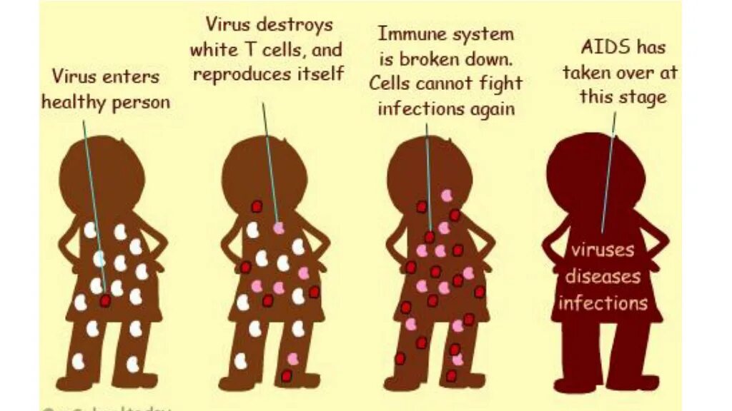 СПИД на английском. ВИЧ картинки на английском. AIDS virus.