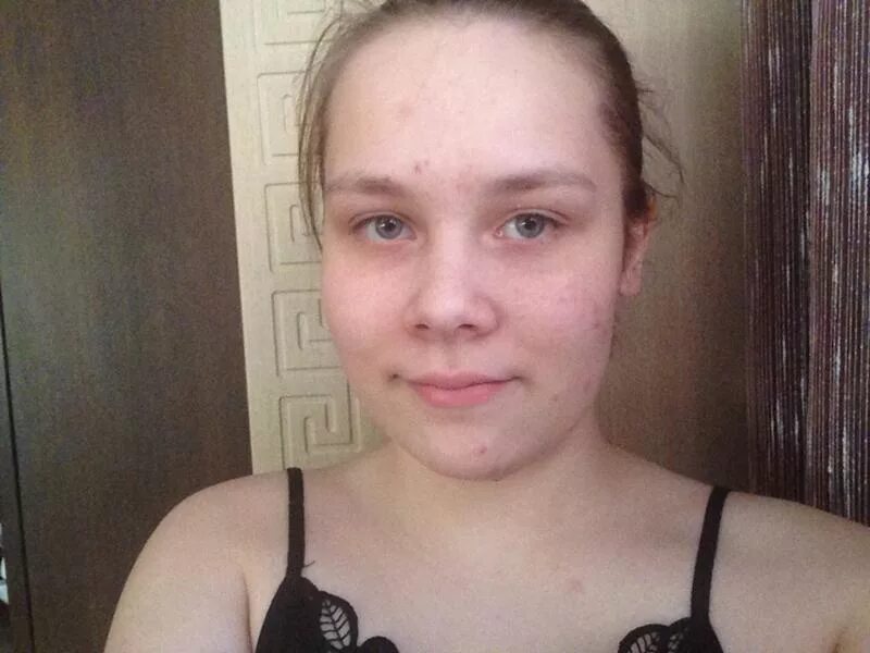 Некрасивый прыщавый. Жирная некрасивая женщина. Некрасивый прыщавый. Девушка без макияжа некрасивая. Девушка с прыщами и желтыми зубами.