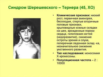 Е тернера