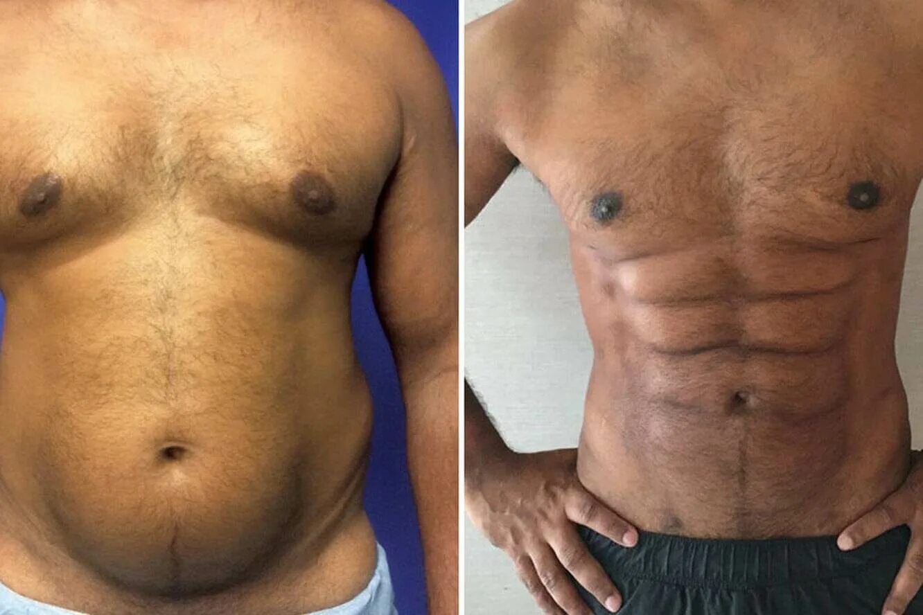 Выпуклый женский живот. Болит бок. Мужской живот. Девушки с животиком и боками. Спасательный круг на животе.