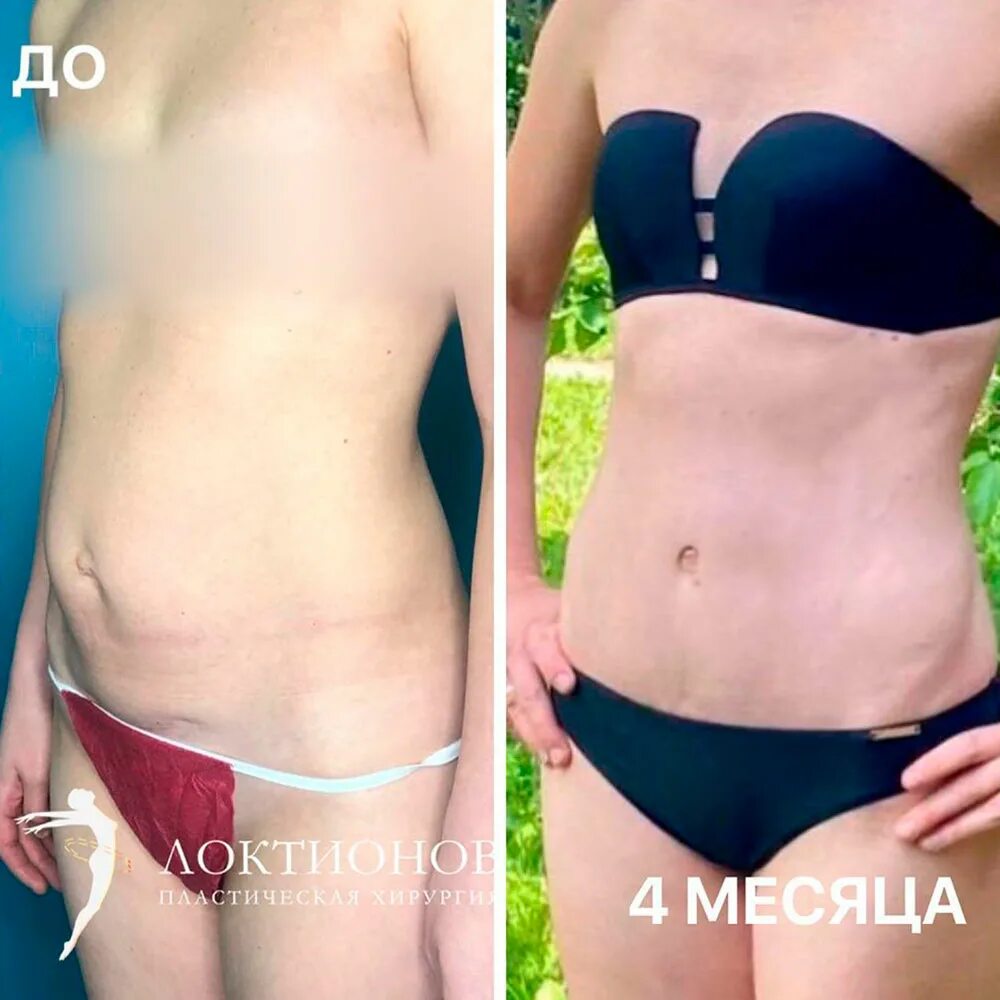 Р после 3. Хардин и зед. Фильм после актриса. Ульбтоаформер лифтинг. Кимберли в фильме после.