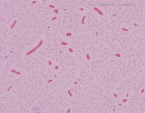Клебсиелла пневмония в цервикальном мазке. Klebsiella pneumoniae окраска по граму. Клебсиелла пневмония в цервикальном мазке. Клебсиелла пневмония в цервикальном мазке. Клебсиелла норма в мазке из зева.