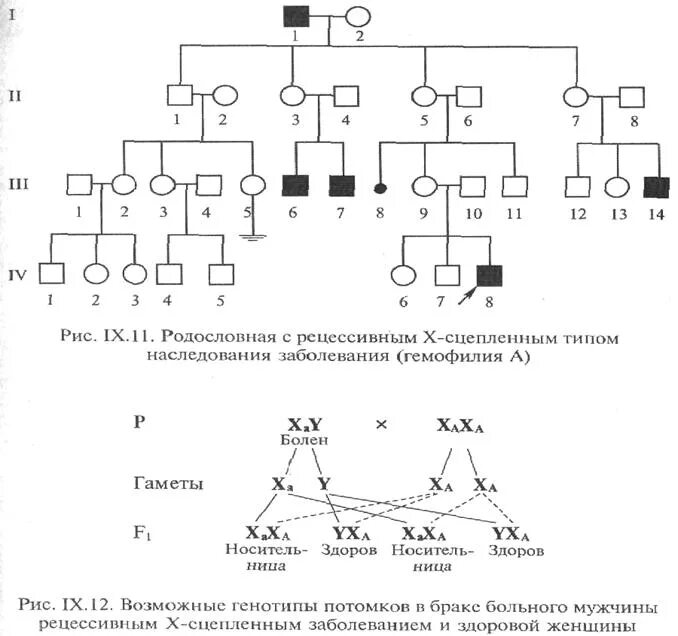 Х-сцепленное рецессивное наследование родословная. Сцепленный с х-хромосомой доминантный Тип наследования схема. Родословные с х сцепленным рецессивным типом наследования. X сцепленный рецессивный Тип наследования.