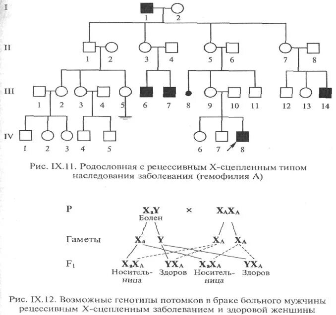 Заболевание y сцепленное рецессивное. Х-сцепленное рецессивное наследование родословная. Сцепленный с х-хромосомой доминантный Тип наследования схема. Родословные с х сцепленным рецессивным типом наследования. X сцепленный рецессивный Тип наследования.