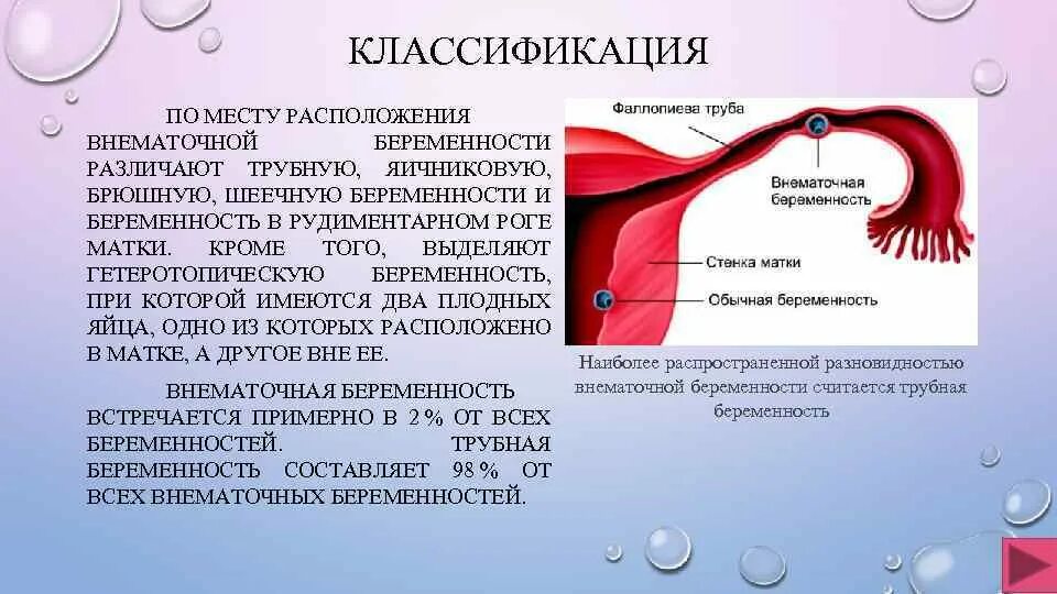 Как отличить внематочную. Внематочная беременность цервикальная. Внематочная беременность в рудиментарном Роге. Клиническая классификация внематочной беременности. Места локализации внематочной беременности.