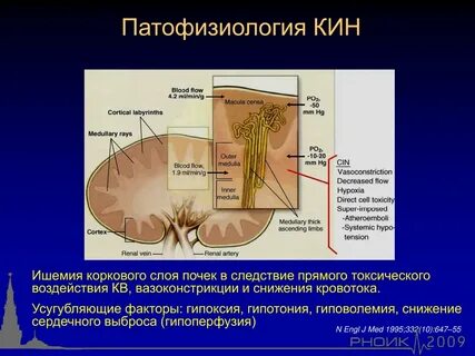 Почечные синусы уплотнены