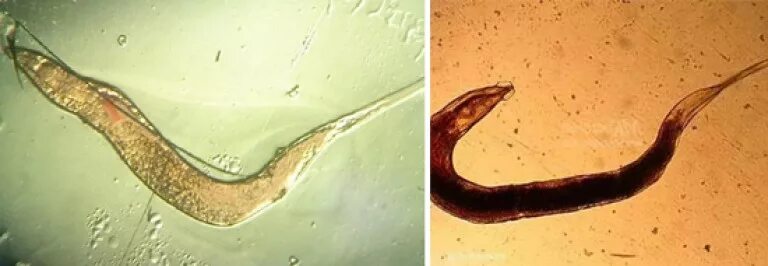 Test for enterobiasis: scraping, smear, feces. How to submit. Reference. Price. 