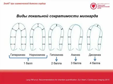 Сегменты сердца