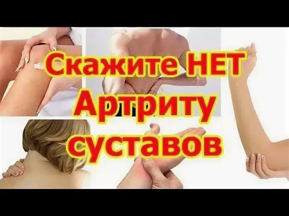 Профилактика артроза и артрита суставов у женщин. Профилактика артроза и артрита суставов у женщин. Памятка советы при заболеваниях суставов. Буклет профилактика ревматоидного артрита. Памятка по профилактике артрозов.