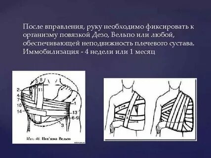 Дезо алгоритм