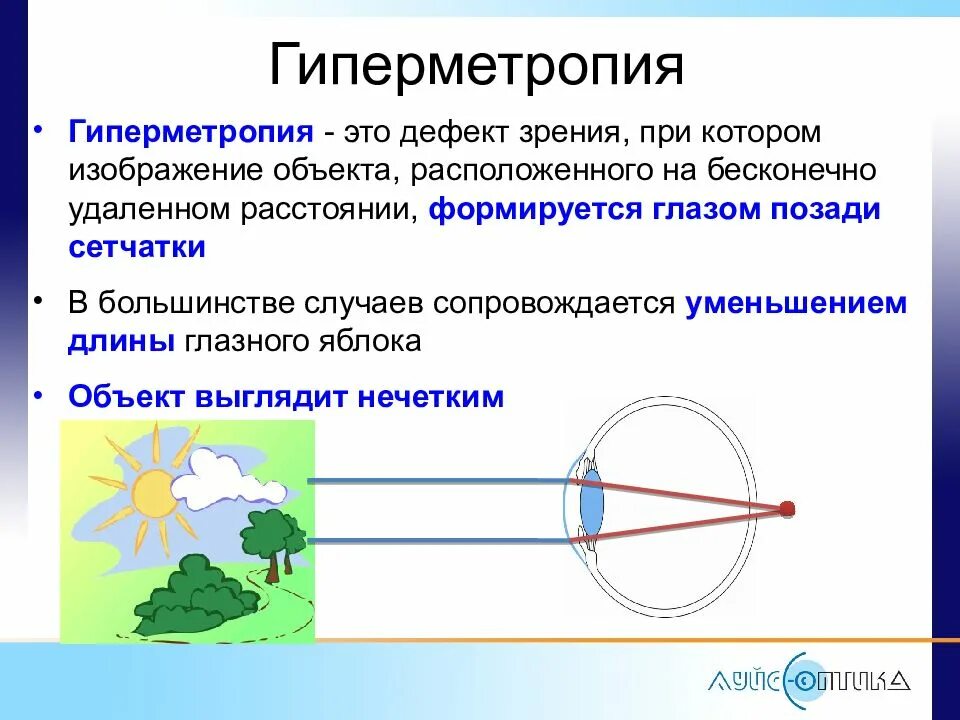 Гиперметропия дальнозоркость. Для гиперметропии характерно. Дальнозоркость (гиперметропия). При дальнозоркости изображение предмета фокусируется. Дальнозоркость (гиперметропия).