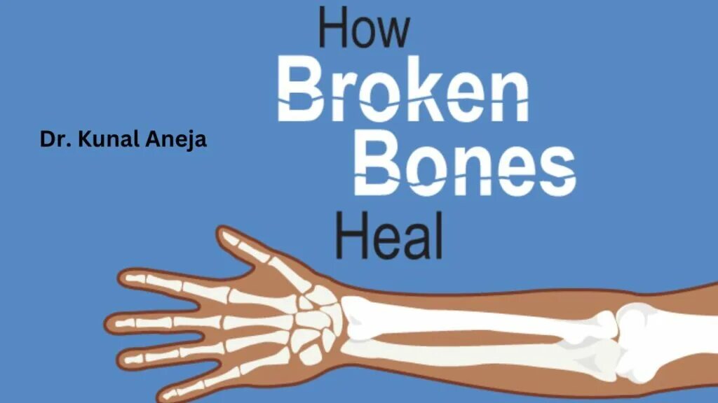 Broken Bones logo. Bones knows. Break bones 4