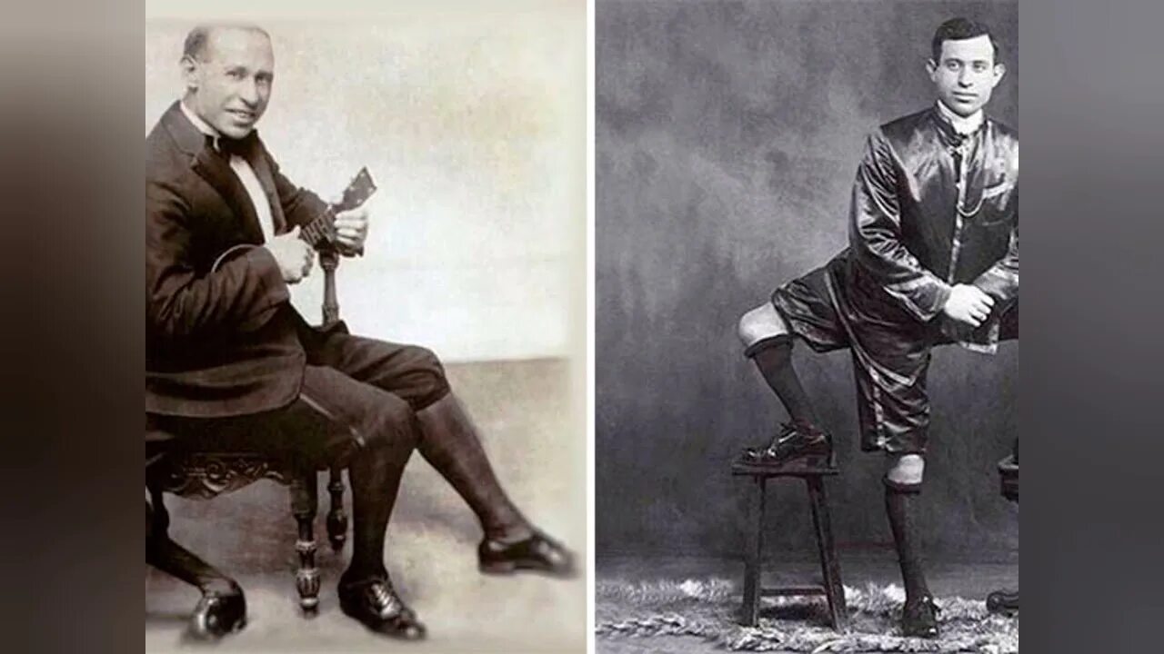 Видит три ноги. Фрэнк Лентини. Франческо (Фрэнк) Лентини. Трёхногий Фрэнк Лентини. Франческо Лентини человек с тремя ногами.1889.