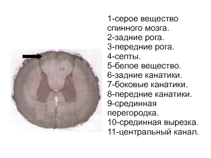 Строение спинного мозга отделы. Белое вещество спинного мозга образует задние рога. Строение серого и белого вещества спинного мозга. Белое вещество спинного мозга образует задние рога. Строение серого вещества в спинном мозге.