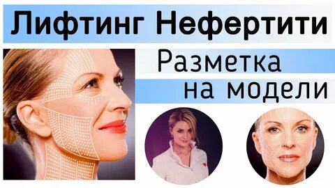 Ботокс нефертити