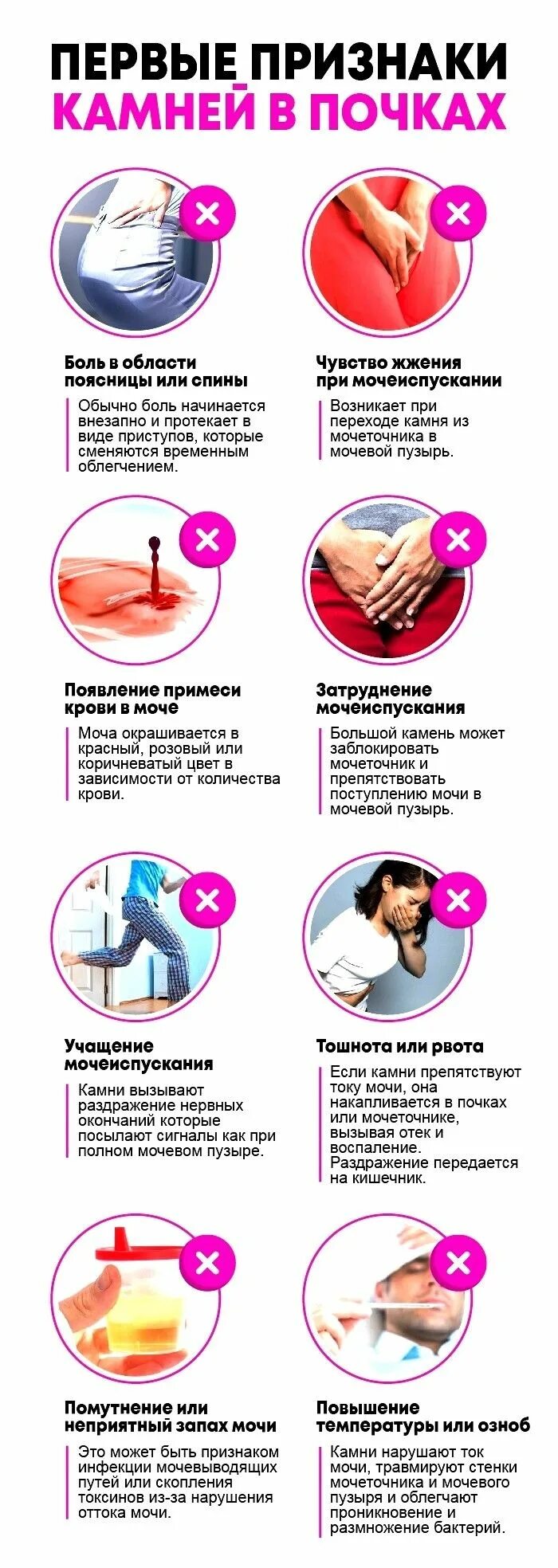 Боли в почках лечение камни. Камнитв почках симптомы. симптомы при камнях в почках. камни в почках признаки симптомы.