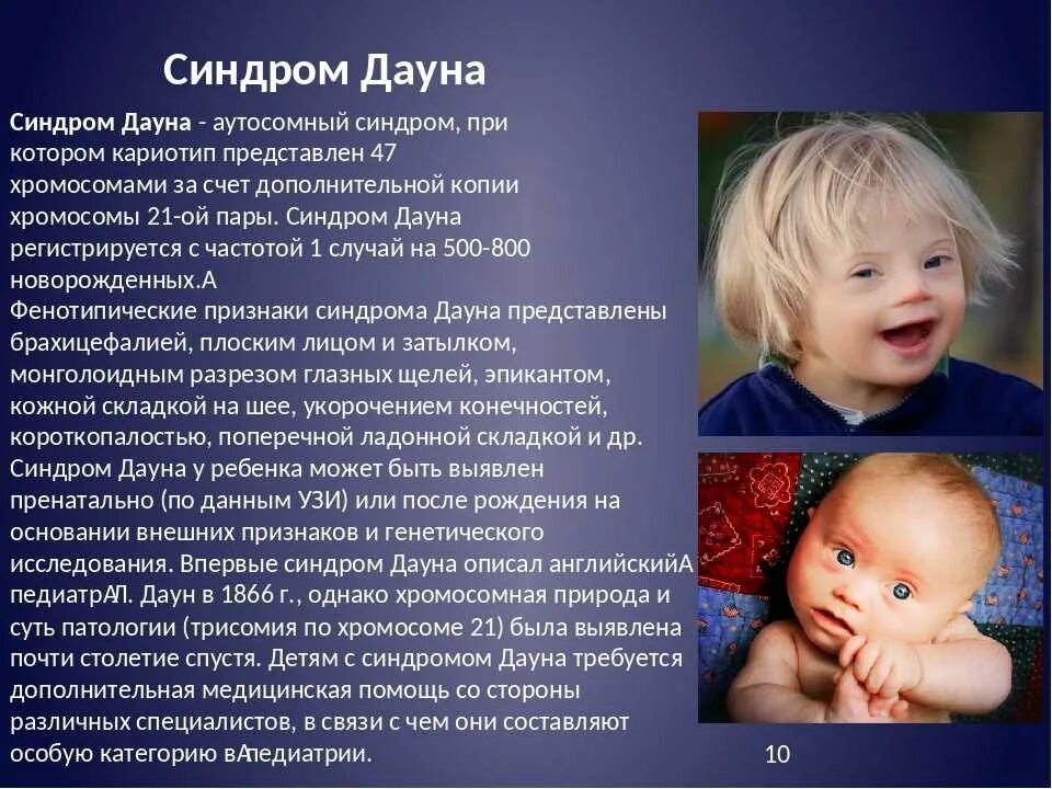 Как называется болезнь взрослый ребенок. Генетические заболевания дауна. болезнь дауна характеристика. синдром дауна характеристика.