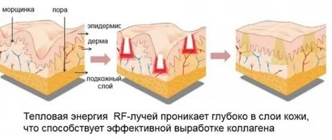 Лифтинг действие