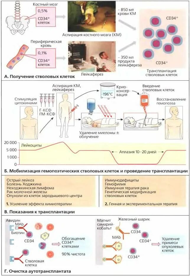 Почему пересадка