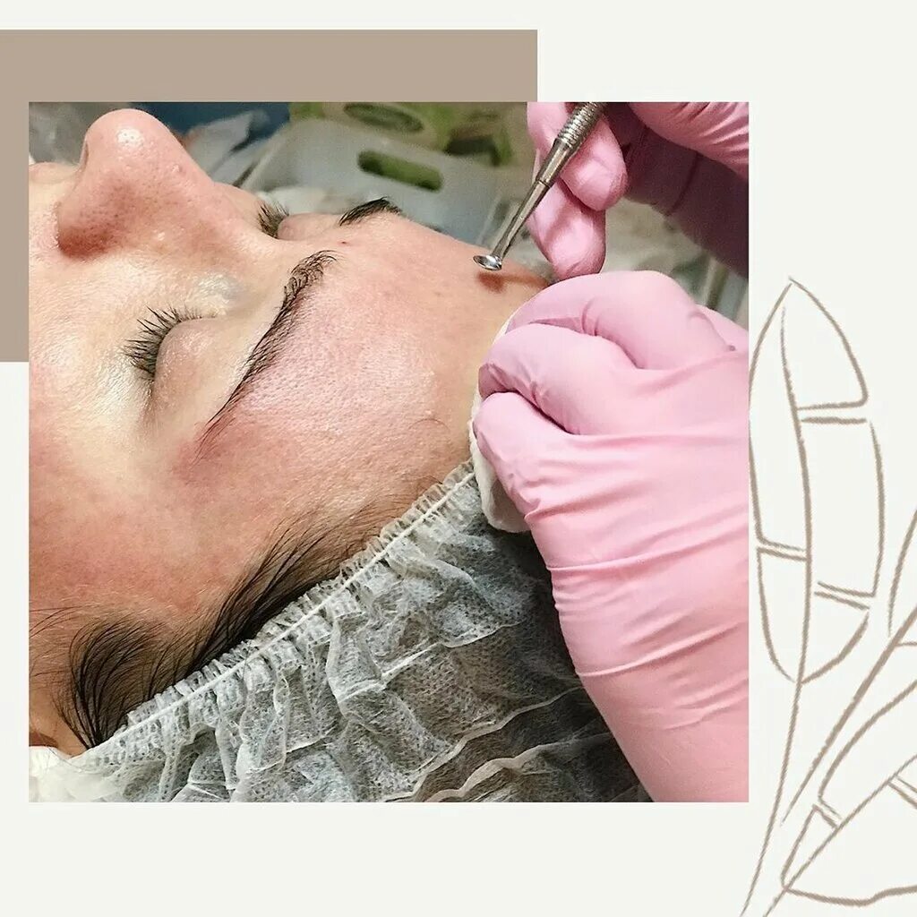 Косметология ялта. Соханя 3 ялта косметолог. Фотосессия косметолога. Косметология ялта. Ялта скин косметология.