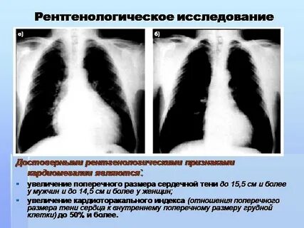 Рентгенологическое исследование является