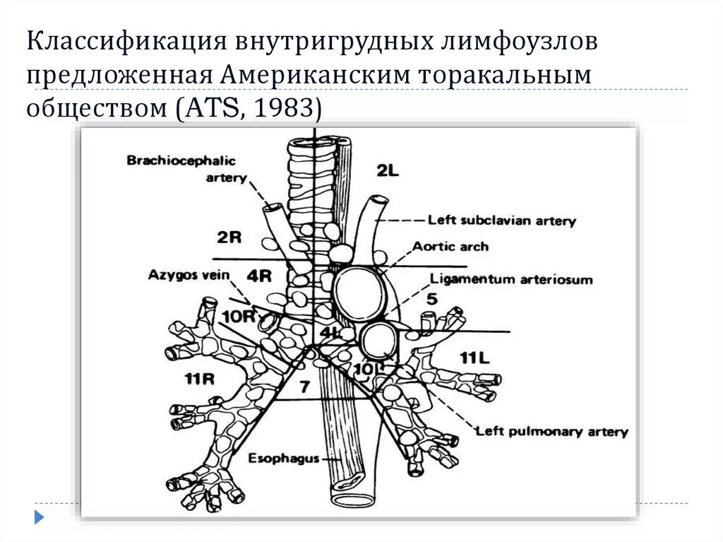 Легочные лимфоузлы. Лимфатические узлы грудной клетки кт. Схема классификации лимфатических узлов. Лимфатические узлы легких анатомия. Лимфатические узлы средостения схема.