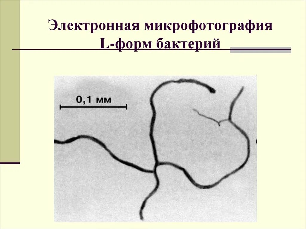 S форма бактерий. Образование l форм бактерий микробиология. L формы бактерий микробиология. L И S формы бактерий. Факторы образования l - форм бактерий.