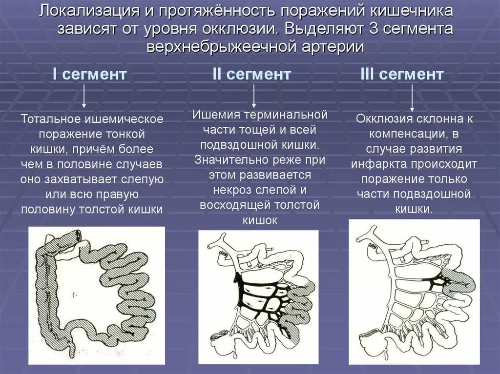 Острое мезентериальное кровообращение. Мезентериальный тромбоз кишка. Тромбоз мезентериальных артерий. Мезентериальный тромбоз этиология. Кровоснабжение верхней брыжеечной артерии.