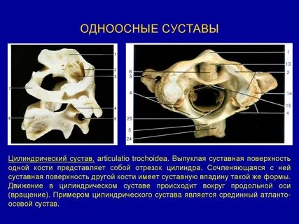 Выбери сустав