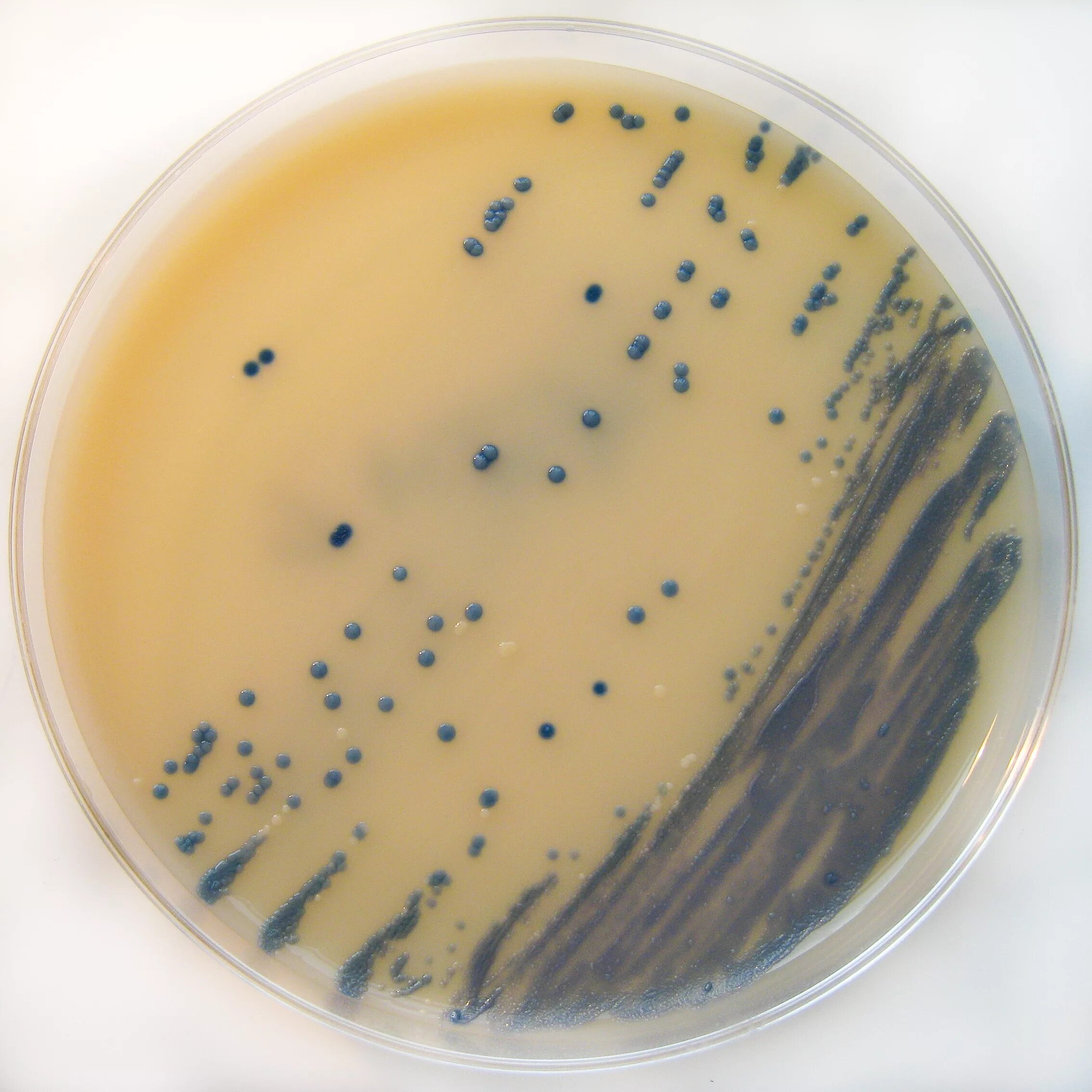 Посев staphylococcus aureus