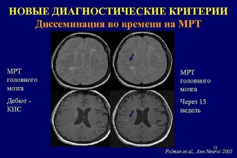 Рассеянный критерии макдональда