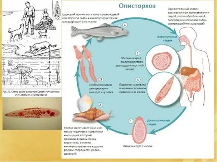 Лямблии и описторхоз