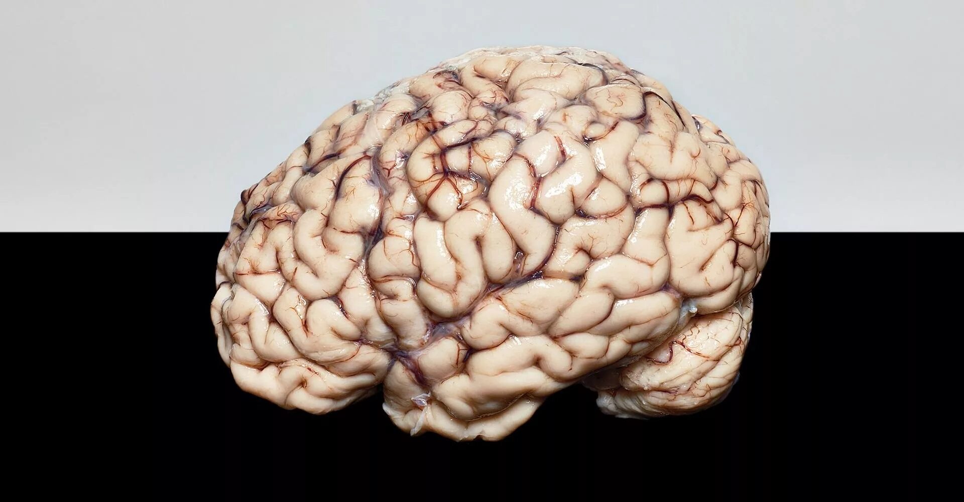 Последний мозг. Какого цвета мозг у человека.