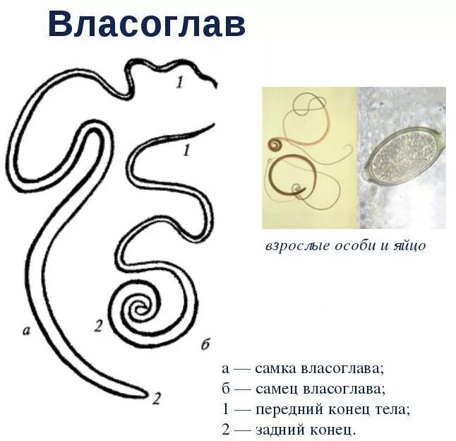 Яйца власоглава и острицы. Трихоцефалез – власоглав. Аскарида, трихинелла, Острица, власоглав. Острицы, власоглав, аскариды.