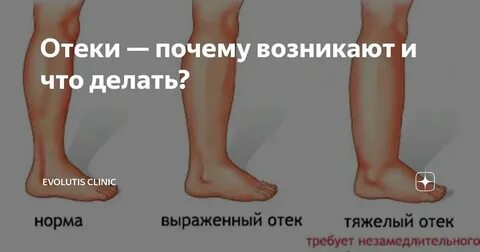 Причины припухнуть