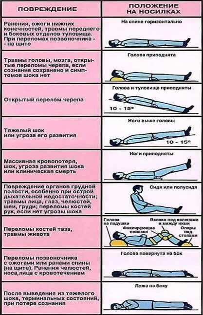 Переломы вывихи ушибы первая медицинская помощь