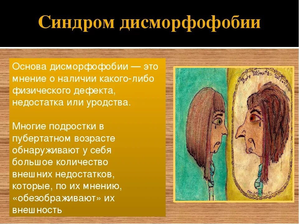 Синдром дисморфофобии. Дисморфофобия. синдром дисморфофобии-дисморфомании. дтсморфобическое расстройство.