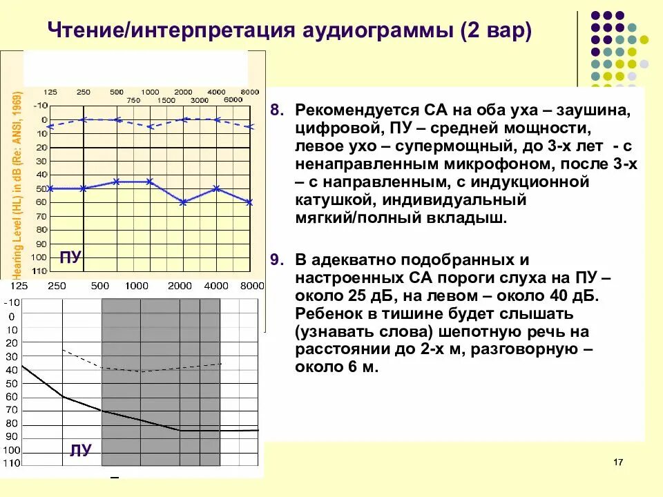 Аудиограмма слуха норма. Кондуктивная тугоухость аудиограмма. Отосклероз аудиограмма. Аудиометрия слуха норма таблица. Аудиограмма в спб